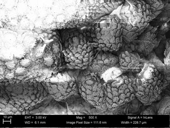 Media type: image;   Invertebrate Zoology 32029 Description: SEM image of specimen.;